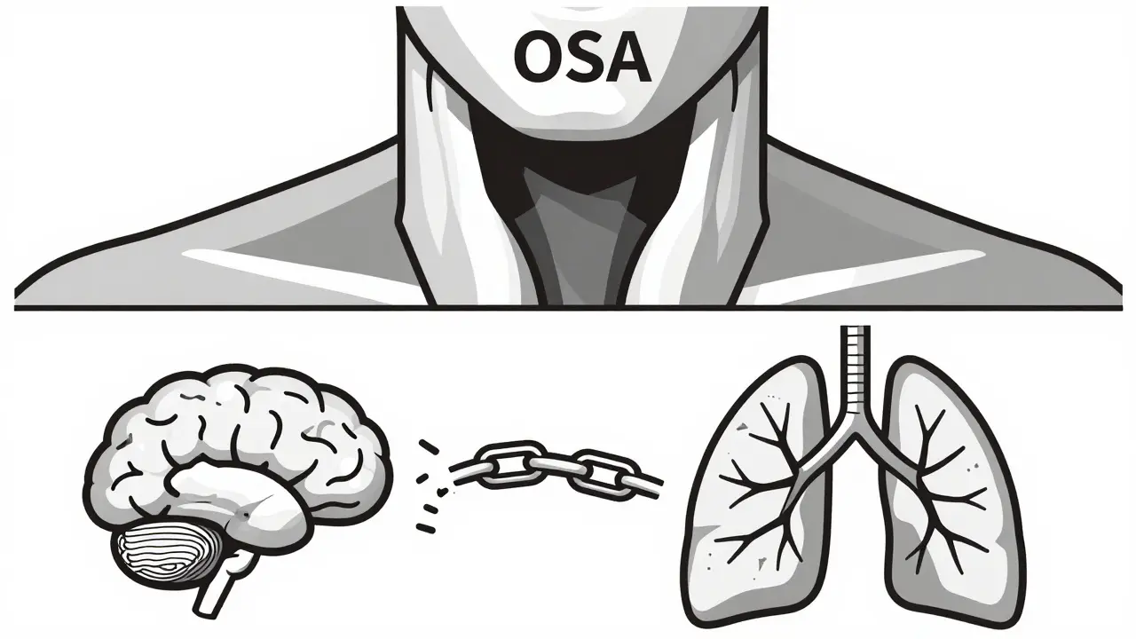 Black and white diagram contrasting blocked airway in OSA with disconnected signals in central apnea.
